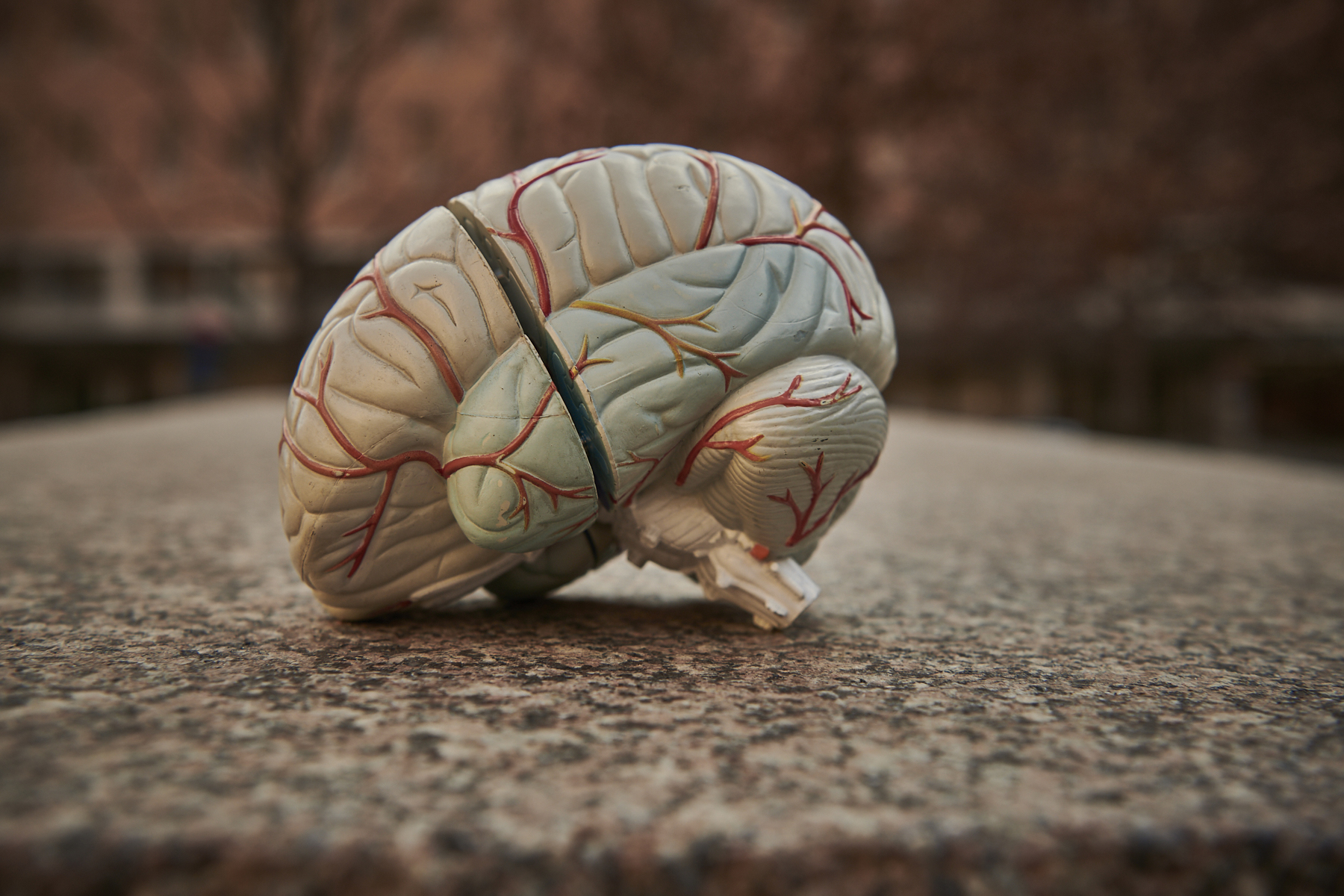 Which Brain Hemorrhage Patients Have Treatable Underlying 