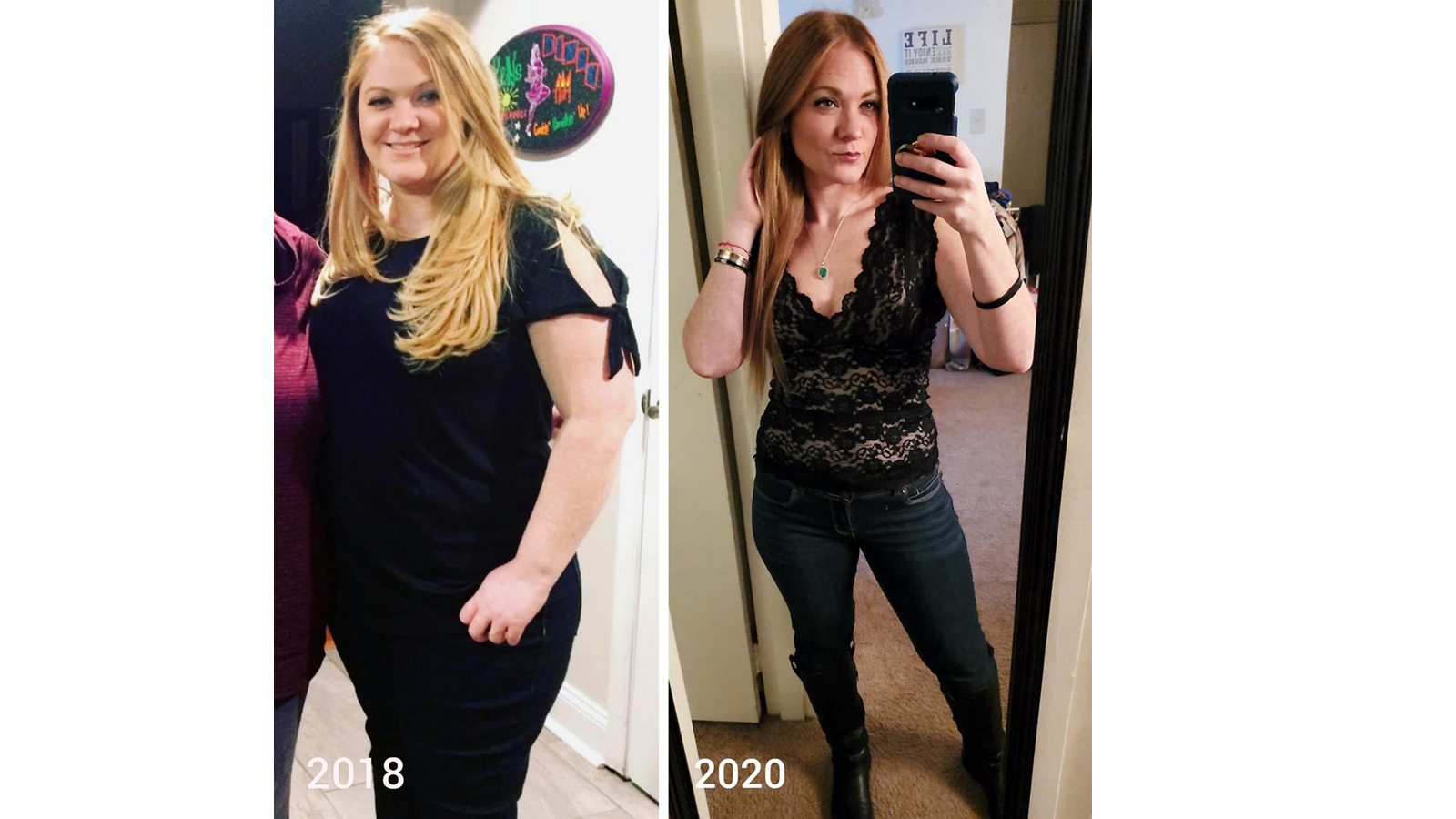 https://www.jeffersonhealth.org/content/dam/health2021/images/photos/photo-shoots/news/bariatric-surgery-patient-story-meghan.png