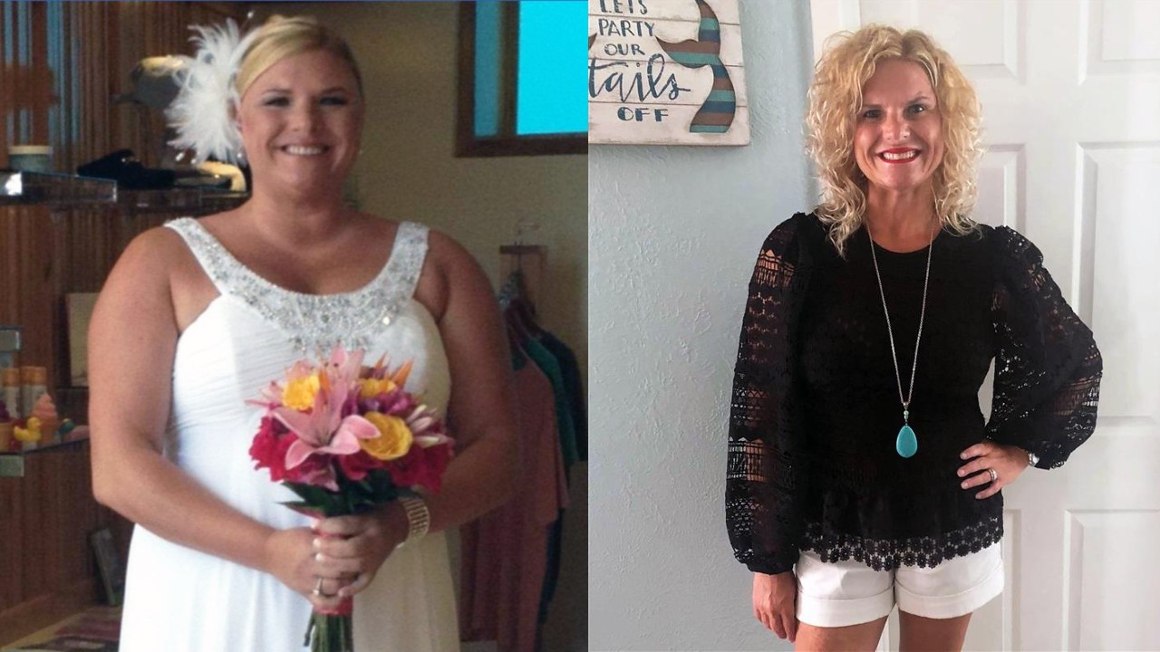 How One Woman’s WeightLoss Surgery Helped Her Save Her Father’s Life