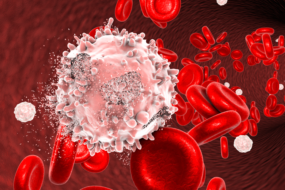 Blood Cancers | Jefferson Health