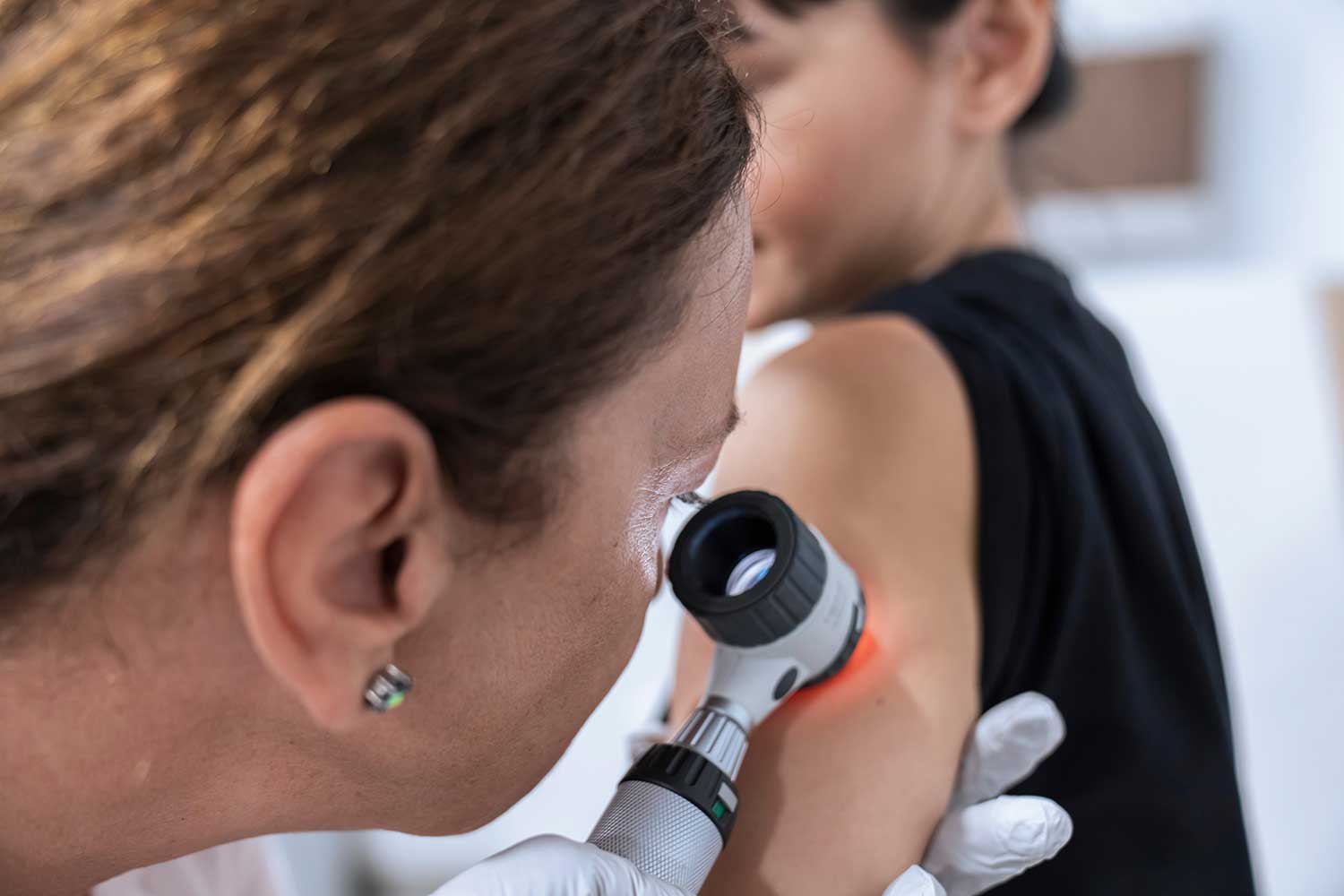 Skin Cancer Testing Skin Cancer Screening Event | Jefferson Health