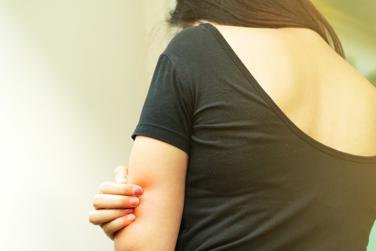 AtHome Remedies to Calm Hives and Itchy Skin Jefferson Health